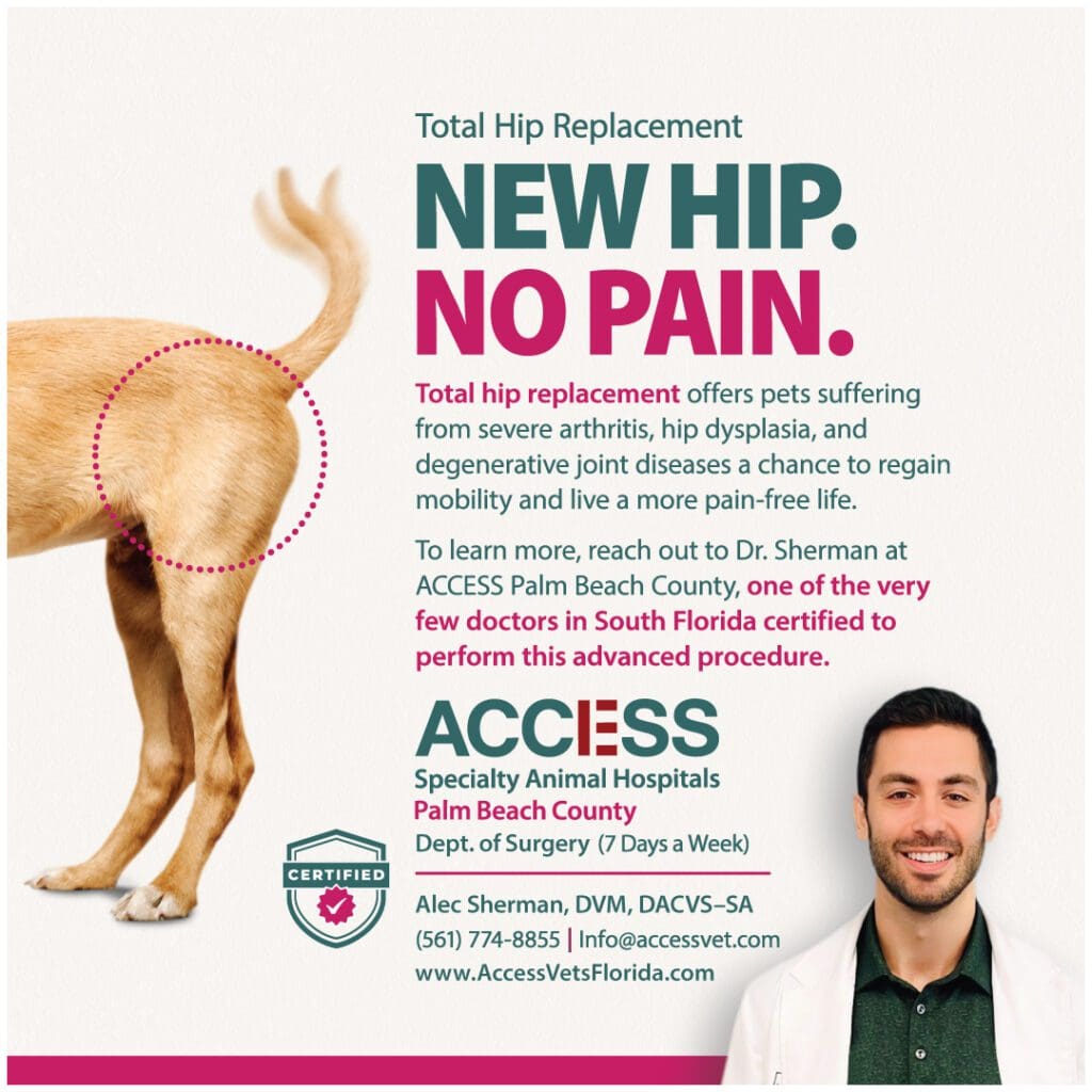 Acess Pbc Total Hip Replacement Alec Sherman V1